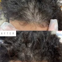 نمایندگی رسمی تونیک تقویت کننده مو هیرفرند (بیز)