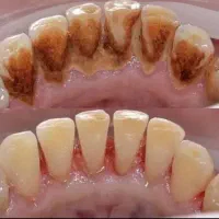 خدمات دندان پزشکی با شرایط و قیمت بسیار مناسب