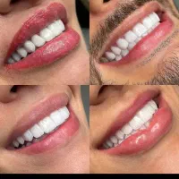 دندانپزشکی تخفیف بازگشایی مدارس با بیمه های تکمیلی|خدمات آرایشگری و زیبایی|اندیشه, اندیشه فاز ۲|دیوار