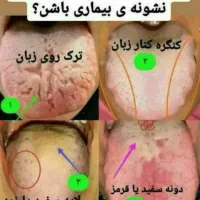 طب سنتی