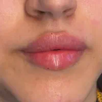 دکتر اکرم آقابیگی پوست مو زیبایی|خدمات آرایشگری و زیبایی|ملایر, |دیوار