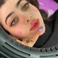 فیلرژل،بوتاکس،کربوکسی،مزوفیشیال،ریموتتوخال نخ لیفت