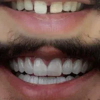 درمانی و زیبایی(سلامت دهان و دندان )