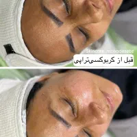 آموزش فیشال و پاکسازی پوست + تخفیف و پرداخت ۲ قسطی|خدمات آموزشی|شیراز, فرهنگ شهر|دیوار