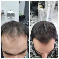 جوانه‌های تازه برای موی شما
