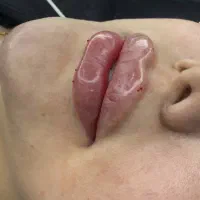 لب روسی تکنیک M وکانتورینگ نچرال و عروسکی