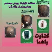 معجزه پک|حراج|قم, باجک دو|دیوار