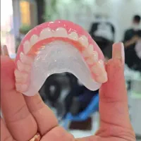 دندان مصنوعی ژله‌ ای بدون لقی
