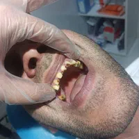 دندان سازی|خدمات آرایشگری و زیبایی|خوی, |دیوار