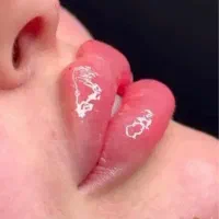 تخفیف ویژه۳روزه ژل فیلربوتاکس بامواداصل کره تضمینی