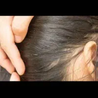 پاکسازی رشک و شپش