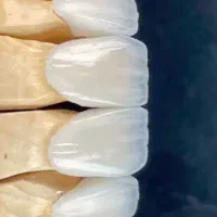 آموزش پودر (پرسلن) گذاری لیرینگ