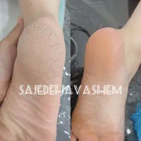 پدیکور پاکسازی|خدمات آرایشگری و زیبایی|اهواز, کوی سعدی|دیوار
