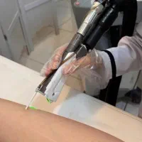 لیزرموهای زائد بادستگاه شاتی 2025 در(نوراباد)