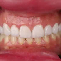 استخدام منشی مطب دندانپزشکی