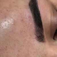 میکروبلیدینگ ابرو و شیدینگ لب