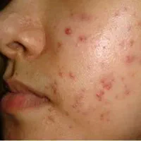 زیبایی صورت.|خدمات آرایشگری و زیبایی|بروجرد, |دیوار