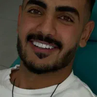 کامبوزیت زیبایی کامپوزیت دندان ضمانت ۵ ساله|خدمات آرایشگری و زیبایی|نهاوند, |دیوار