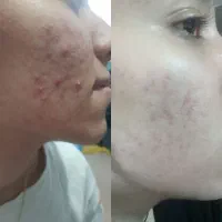 طب سنتی|آرایشی، بهداشتی، درمانی|کرمان, |دیوار