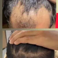 جفت شیش فصل تازه مو