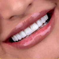 .تخفیف ویژه دندان پزشکی .کامپوزیت.وتمام خدامات|خدمات آرایشگری و زیبایی|اردبیل, |دیوار