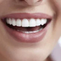 تخفیف ویژه بهترین برندهای ایمپلنت|خدمات آرایشگری و زیبایی|شیراز, زرگری|دیوار