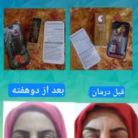 سرم ویتامین Cآریا|آرایشی، بهداشتی، درمانی|تهران, محمودیه|دیوار