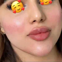 ژل و بوتاکس|خدمات آرایشگری و زیبایی|کارون, |دیوار