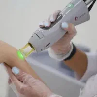 دستگاه لیزر الکساندرایت کندلا 2025آمریکا