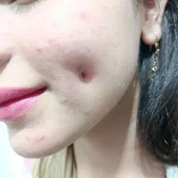 آموزش و خدمات زیبایی و درمانی|خدمات آرایشگری و زیبایی|خرمشهر, |دیوار