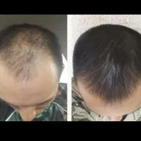 محرم امسال دیگه موهاتو پرپشت کن گیاهی
