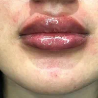 استخدام  منشی ، خدمات  و اوپراتور  لیزر