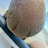 ناخن و کفسابی پا و بافت مو