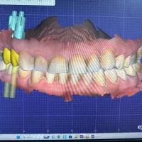 تکنسین ماهر دندانسازی