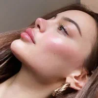 خدمات زیبایی ژل، بوتاکس،جوانساز در شرق تهران|خدمات زیبایی و سلامت|تهران, سبلان (لشگر)|دیوار