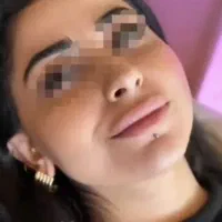 تزریق تخصصی فیلر صورت و لب رایگان جهت مدل|خدمات آرایشگری و زیبایی|تهران, ونک|دیوار