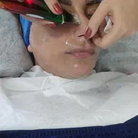 پاکسازی فیشال جوانسازی پوست|خدمات آرایشگری و زیبایی|شیراز, شهرک سراج‎|دیوار