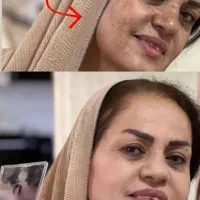 پنکک لاکچری کوین اصل اورجینال|آرایشی، بهداشتی، درمانی|اهواز, کیانپارس |دیوار