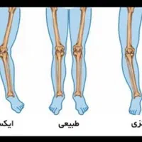 مجموعه تخصصی اصلاح ناهنجاری‌های اسکلتی
