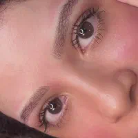 میکروبلیدینگ میکروپیگمنتیشن