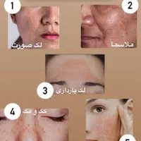 محصولات آرایشی و بهداشتی و درمانی وکرم های ضدلک|آرایشی، بهداشتی، درمانی|شیراز, گویم|دیوار