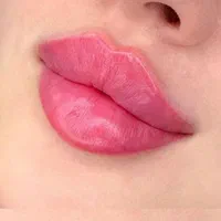 (کلینیک دنا)  فیلر لب ژل‌لب ،زاویه سازی ،طبیعی|خدمات آرایشگری و زیبایی|یاسوج, |دیوار