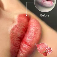 انجام خدمات شیدینگ لب / مدل خدمات لب / ساکورالیپس