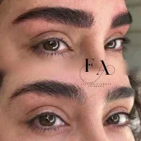 میکرو فیبروز ابرو