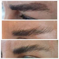 پاک کردن تتو صورت و بدن|خدمات آرایشگری و زیبایی|شاهین‌شهر, مخابرات (شهید بهشتی)|دیوار