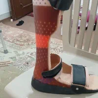 اسپیلنت پای راست
