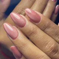 کاشت اولیه(۴۰۰)ترمیم(۲۵۰)