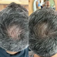 تاس شدی و کلت خالی شده اینجا رو ببین و  غصه نخور