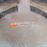 خدمات ژل و بوتاکس|خدمات آرایشگری و زیبایی|بهبهان, |دیوار