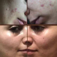 ارایشی بهداشتی